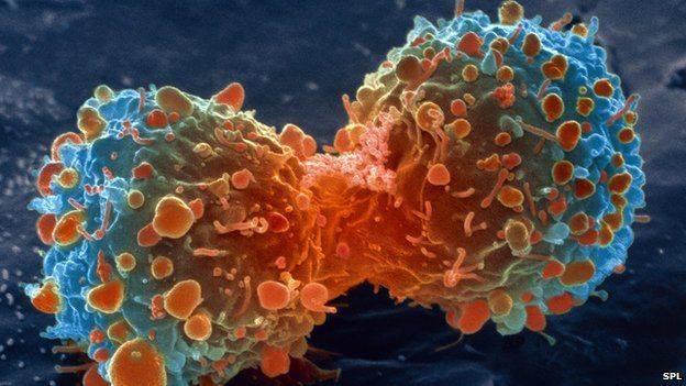 How an ordinary painkiller could slow cancer growth