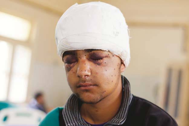 500 pellet victims below 20: Kashmir Media