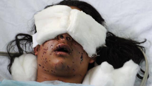 Indian military is inflicting blinding as collective punishment on Kashmiris.