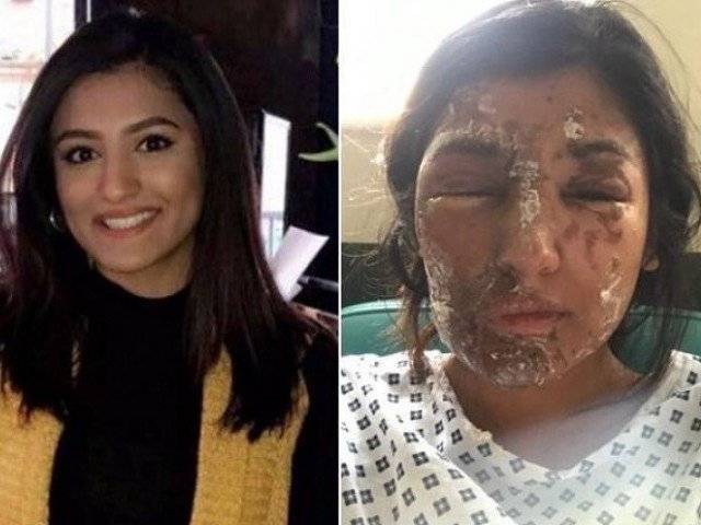 Acid attack on Pakistani model Resham Khan in London shocks all