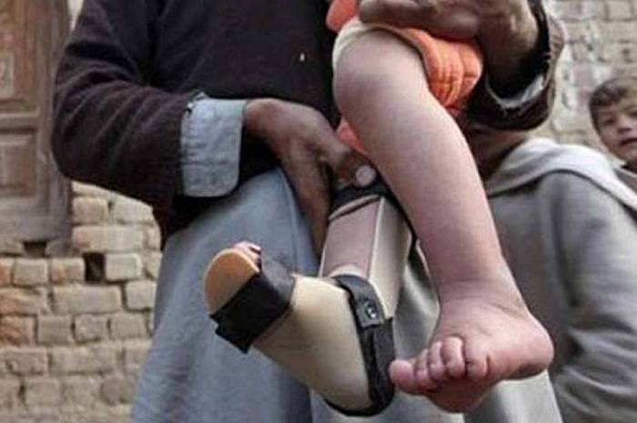 Pakistan faces a setback over the Polio eradication front