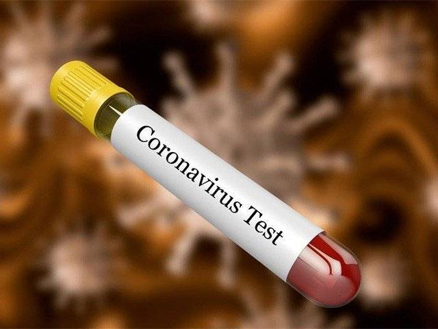 Pakistani Scientists at NUST make breakthrough development against Coronavirus