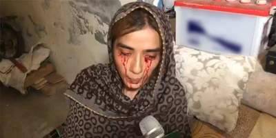 Pakistani girl who sheds blood tears seeks financial help 