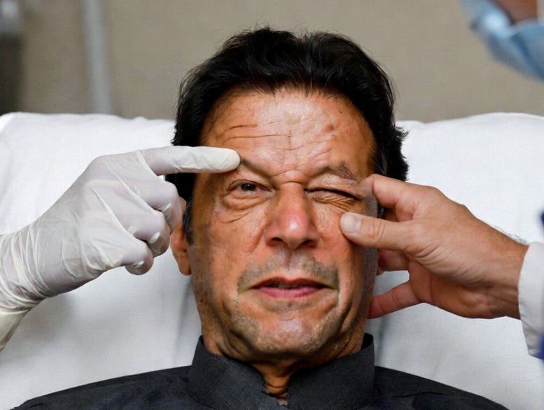 Government Sets Condition For Sending Imran Khan Abroad on Medical Grounds